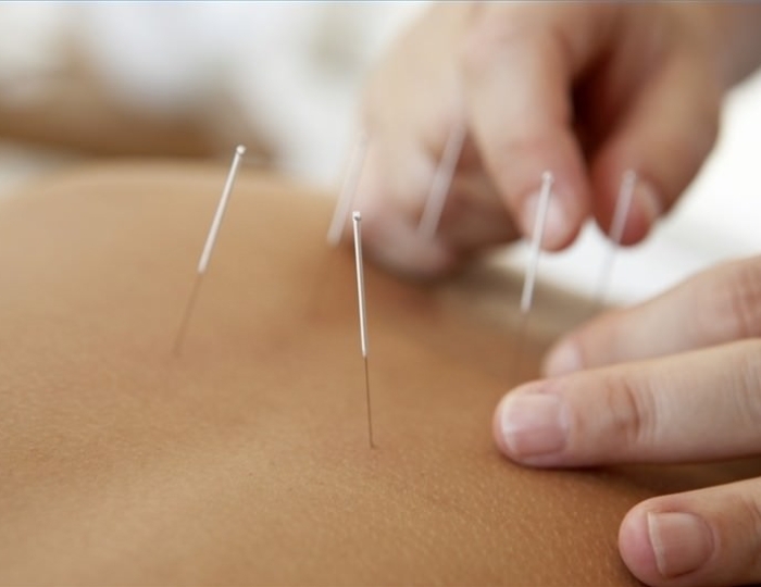 Иглорефлексотерапия - Оздоровительные услуги - Санаторий «Летцы»